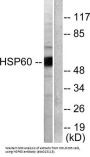 Heat Shock 60 kDa Protein 1, Chaperonin / HSP60 (HSPD1) Antibody