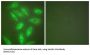 Keratin 18 (KRT18) Antibody