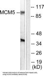 Minichromosome Maintenance Deficient 5 (MCM5) Antibody