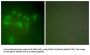 Mdm2 p53 Binding Protein Homolog (MDM2) Antibody