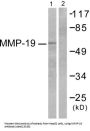 Matrix Metalloproteinase-16 (MMP-16) Antibody