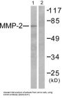 Matrix Metalloproteinase 2 (MMP2) Antibody