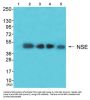 Gamma-Enolase (ENO2) Antibody