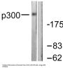 Histone Acetyltransferase P300 (EP300) Antibody