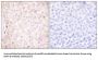 Stefin B (STFB) Antibody