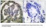 Transforming Growth Factor Beta-2 (TGFB2) Antibody