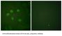 SUMO-Activating Enzyme Subunit 1 (AOS1) Antibody