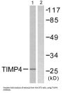 Metalloproteinase Inhibitor 4 (TIMP4) Antibody