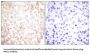X-Ray Repair Cross Complementing 1 (XRCC1) Antibody