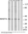 Microtubule Associated Serine/threonine Kinase Family Member 4 (MAST4) Antibody