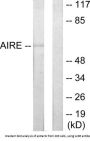 Autoimmune Regulator (AIRE) Antibody