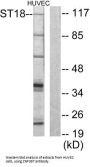 Zinc Finger Protein 387 (ZNF387) Antibody