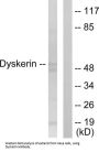 Dyskerin (DKC1) Antibody