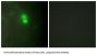 Dyskerin (DKC1) Antibody