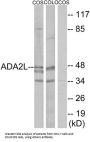 Transcriptional Adapter 2-Like (ADA2L) Antibody
