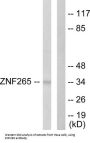 Zinc Finger Protein 265 (ZNF265) Antibody