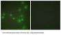 Zinc Finger Protein 265 (ZNF265) Antibody