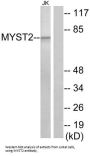 MOZ, YBF2/SAS3, SAS2 And TIP60 Protein 2 (MYST2) Antibody
