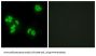 Tumor Necrosis Factor Alpha-Induced Protein 8 (TFIP8) Antibody