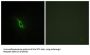 Adrenergic Receptor Alpha 2A (ADRA2A) Antibody