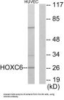 Homeobox Protein Hox-C6 (HOXC6) Antibody
