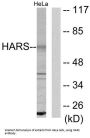 Histidine--tRNA Ligase, Cytoplasmic (HARS) Antibody