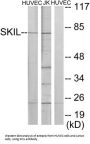 SKI Like Oncogene (SKIL) Antibody