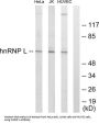 Heterogeneous Nuclear Ribonucleoprotein L (hnRNP L) Antibody