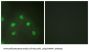 Heterogeneous Nuclear Ribonucleoprotein L (hnRNP L) Antibody