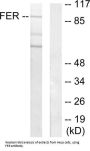 Tyrosine Protein Kinase Fer (FER) Antibody