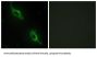 Creatine Kinase, Mitochondrial 2 (CKMT2) Antibody