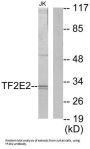 Transcription Initiation Factor IIE Subunit Beta (TF2E2) Antibody