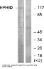 Ephrin Type-B Receptor 2 (EPHB2) Antibody