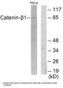 Catenin Beta (CTNNB1) Antibody