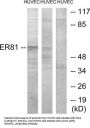 ETS Translocation Variant 1 (ETV1) Antibody