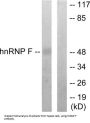 Heterogeneous Nuclear Ribonucleoprotein F (hnRNP F) Antibody