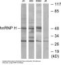 Heterogeneous Nuclear Ribonucleoprotein H (hnRNP H) Antibody