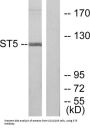 Suppression Of Tumorigenicity 5 (ST5) Antibody