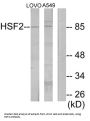 Heat Shock Factor Protein 2 (HSF2) Antibody