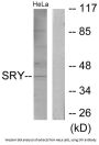 Sex-Determining Region Y Protein (SRY) Antibody