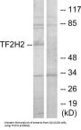 General Transcription Factor IIH Subunit 2 (TF2H2) Antibody