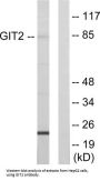 ARF GTPase Activating Protein GIT2 (GIT2) Antibody