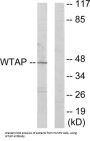 WT1 Associated Protein (WTAP) Antibody