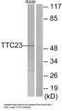 Tetratricopeptide Repeat Domain 23 (TTC23) Antibody