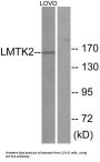 Lemur Tyrosine Kinase 2 (LMTK2) Antibody