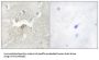 Lemur Tyrosine Kinase 2 (LMTK2) Antibody