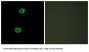 Lemur Tyrosine Kinase 2 (LMTK2) Antibody