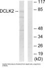 Serine/Threonine-Protein Kinase DCLK2 (DCLK2) Antibody