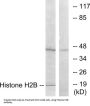 Histone H2B Antibody