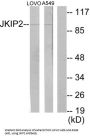 Janus Kinase And Microtubule Interacting Protein 2 (JAKMIP2) Antibody